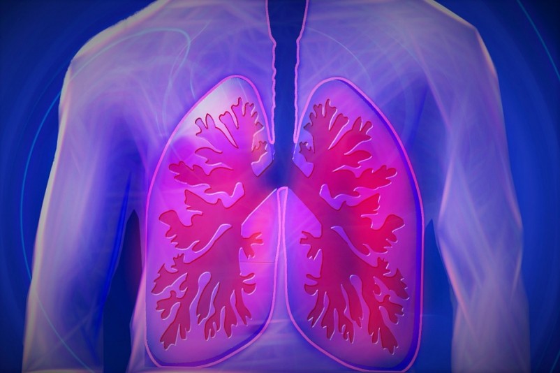 Top 10 Best Mesothelioma Lawyers & Attorneys